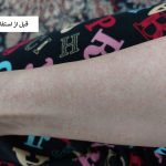 لوسیون بدن مدیلن مناسب انواع پوست ۱۵۰ میلی لیتر